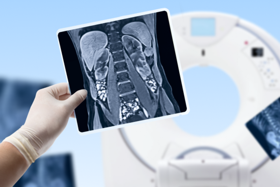 Комплекс МРТ "Весь живот"